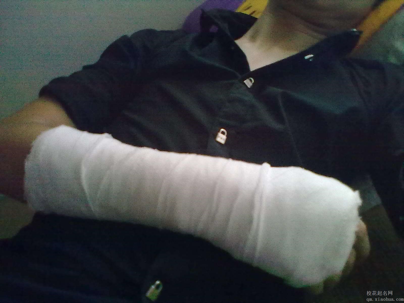 梦见手断了周公解梦，梦见手断了是什么意思？