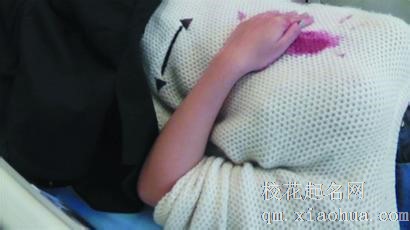 梦见胸口被刺周公解梦，梦见胸口被刺是什么意思？