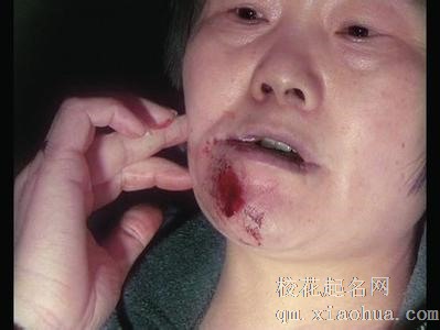 梦见被炸到脸周公解梦，梦见被炸到脸是什么意思？