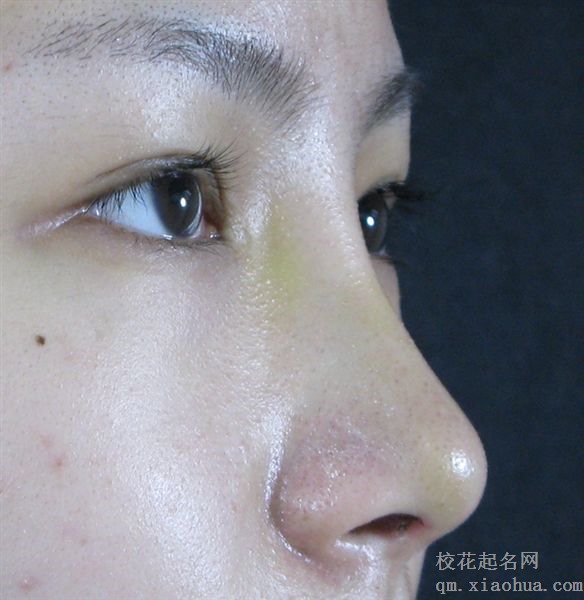 梦见鼻梁 鼻柱周公解梦，梦见鼻梁 鼻柱是什么意思？