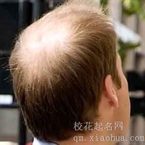 梦见谢顶周公解梦，梦见谢顶是什么意思？