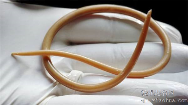 梦见蛔虫周公解梦，梦见蛔虫是什么意思？