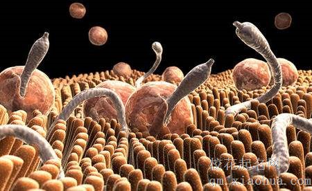 梦见寄生虫周公解梦，梦见寄生虫是什么意思？