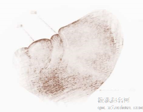 梦见脾脏　周公解梦之梦到脾脏