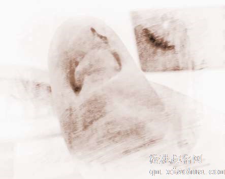 梦见指甲变黑　周公解梦之梦到指甲变黑