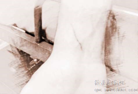 梦见猫抓流血　周公解梦之梦到猫抓流血