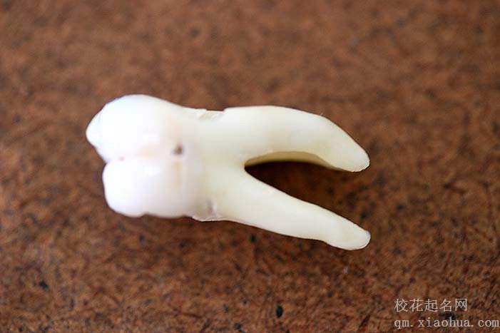 梦见牙掉了 牙齿掉了周公解梦，梦见牙掉了 牙齿掉了是什么意思？