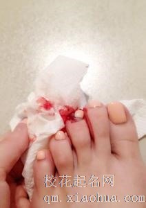梦见脚趾流血周公解梦，梦见脚趾流血是什么意思？