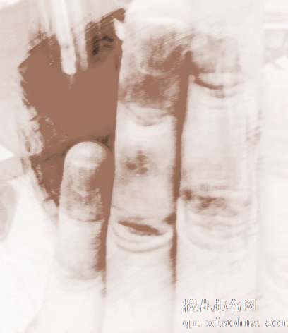 梦见蜜蜂蛰我　周公解梦之梦到蜜蜂蛰我