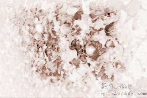 梦见冰雹砸我　周公解梦之梦到冰雹砸我