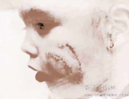 梦见狗咬孩子　周公解梦之梦到狗咬孩子