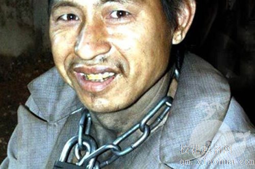 梦见精神病的男人