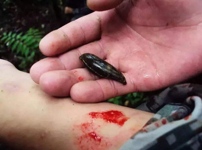 水蛭的捕捉方法和捕后处理