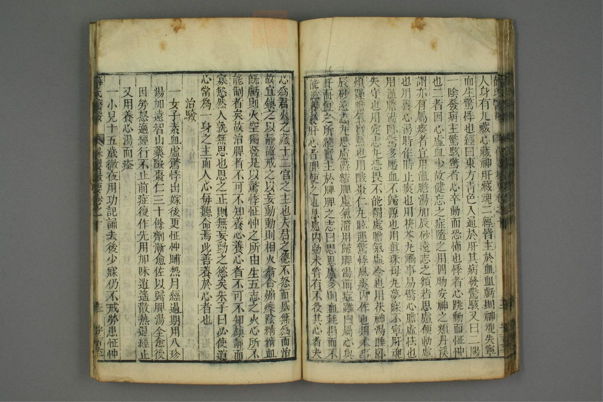 保婴撮要_古籍图_第5册_第273页