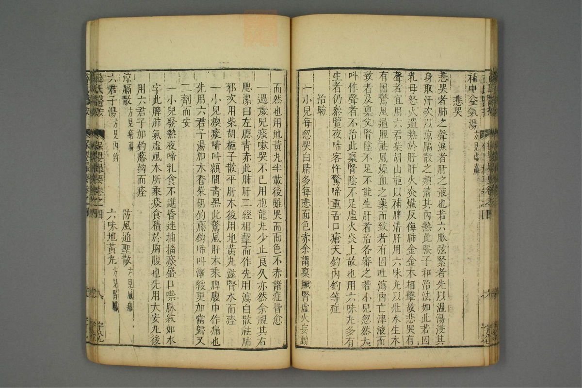 保婴撮要_古籍图_第2册_第93页